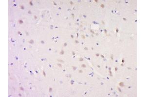 Paraformaldehyde-fixed, paraffin embedded rat brain, Antigen retrieval by boiling in sodium citrate buffer (pH6) for 15min, Block endogenous peroxidase by 3% hydrogen peroxide for 30 minutes, Blocking buffer (normal goat serum) at 37°C for 20min, Antibody incubation with Rabbit Anti-SNAP91/AP180 Polyclonal Antibody, Unconjugated  at 1:500 overnight at 4°C, followed by a conjugated secondary and DAB staining. (SNAP91 antibody  (AA 201-300))