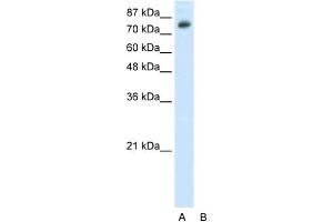 WB Suggested Anti-TSC22D2 Antibody Titration:  0. (TSC22D2 antibody  (N-Term))