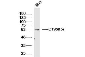 Siha lysates probed with C19orf57 Polyclonal Antibody, Unconjugated  at 1:300 dilution and 4˚C overnight incubation.