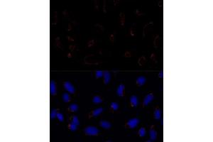 Immunofluorescence analysis of U2OS cells using TR antibody (ABIN1683134, ABIN5664756, ABIN5664758 and ABIN6220605) at dilution of 1:100. (TRAP1 antibody  (AA 445-704))