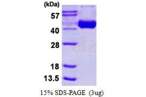 Image no. 1 for Hemagglutinin (HA) protein (His tag) (ABIN1098250)