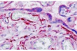 Human Placenta: Formalin-Fixed, Paraffin-Embedded (FFPE) (ARHGEF2 antibody  (AA 383-432))