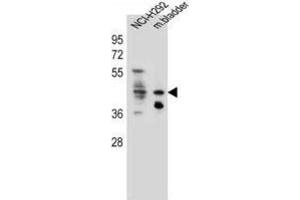 Western Blotting (WB) image for anti-Growth Hormone Secretagogue Receptor (GHSR) antibody (ABIN2996415) (GHSR antibody)
