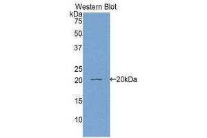 Western Blotting (WB) image for anti-Retinol Binding Protein 5, Cellular (RBP5) (AA 2-135) antibody (ABIN1860418)