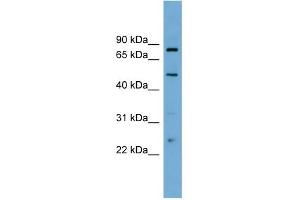 WB Suggested Anti-TFEB Antibody Titration: 0.