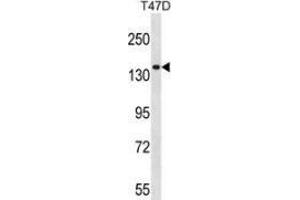 Western blot analysis in T47D cell line lysates (35ug/lane) using Myosin-Ie Antibody (N-term).