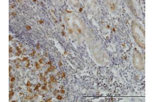 Immunoperoxidase of monoclonal antibody to RRM2 on formalin-fixed paraffin-embedded human stomach. (RRM2 antibody  (AA 1-110))