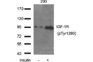 Western blot analysis of extract from 293 cells using IGF-1R (Phospho-Tyr1280).