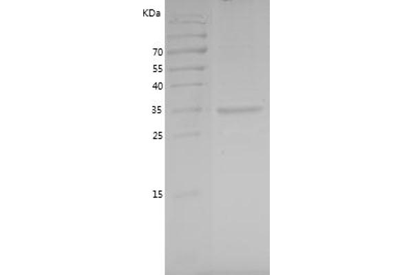 TRAM1 Protein (AA 310-374) (GST tag)