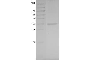Western Blotting (WB) image for Translocation Associated Membrane Protein 1 (TRAM1) (AA 310-374) protein (GST tag) (ABIN7125474) (TRAM1 Protein (AA 310-374) (GST tag))