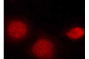 Immunofluorescence (IF) image for anti-Androgen Receptor (AR) (pSer213) antibody (ABIN3020082) (Androgen Receptor antibody  (pSer213))