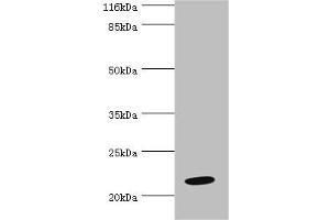 Western blot All lanes: NME6 antibody at 2 μg/mL + Hela whole cell lysate Secondary Goat polyclonal to rabbit IgG at 1/10000 dilution Predicted band size: 22, 14, 19 kDa Observed band size: 22 kDa (NME6 antibody  (AA 1-186))