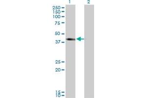 Western Blot analysis of SLC12A1 expression in transfected 293T cell line by SLC12A1 monoclonal antibody (M03), clone 4H4. (SLC12A1 antibody  (AA 80-172))