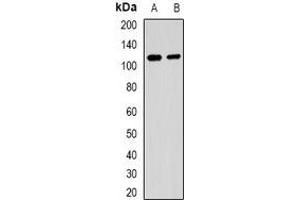 Western blot analysis of MALT1 expression in Raji (A), 293T (B) whole cell lysates. (MALT1 antibody)