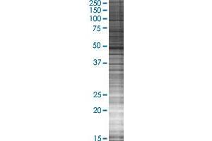 AP4M1 transfected lysate. (AP4M1 293T Cell Transient Overexpression Lysate(Denatured))