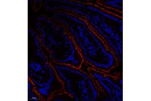 Immunofluorescence of paraffin embedded mouse duodenum using Treh (ABIN7076006) at dilution of 1:650 (200x lens) (TREH antibody)