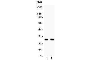 Western blot testing of Olig1 antibody and Lane 1:  U87;  2: HeLa lysate (OLIG1 antibody  (N-Term))