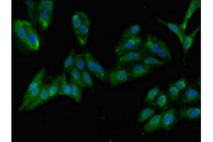 Immunofluorescent analysis of Hela cells using ABIN7144546 at dilution of 1:100 and Alexa Fluor 488-congugated AffiniPure Goat Anti-Rabbit IgG(H+L) (GIT1 antibody  (AA 470-642))