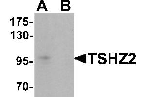 Western blot analysis of TSHZ2 in A-20 cell lysate with TSHZ2 antibody at 1 µg/mL in (A) the absence and (B) the presence of blocking peptide. (TSHZ2 antibody  (N-Term))
