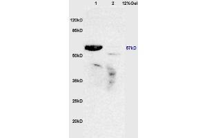 Lane 1: mouse lung lysates Lane 2: mouse brain lysates probed with Anti ROR Gamma/RORC/NR1F3 Polyclonal Antibody, Unconjugated (ABIN750298) at 1:200 in 4 °C. (RORC antibody)