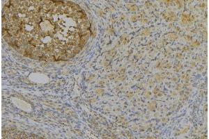ABIN6277387 at 1/100 staining Human uterus tissue by IHC-P. (IGFBPI antibody  (C-Term))