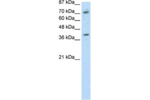 Western Blotting (WB) image for anti-Zinc Finger Protein 282 (ZNF282) antibody (ABIN2461700) (ZNF282 antibody)