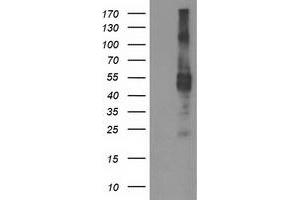 HEK293T cells were transfected with the pCMV6-ENTRY control (Left lane) or pCMV6-ENTRY TMPRSS5 (Right lane) cDNA for 48 hrs and lysed. (TMPRSS5 antibody)