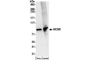 Western Blotting (WB) image for anti-Minichromosome Maintenance Complex Component 5 (MCM5) (AA 1-50) antibody (ABIN7454594) (MCM5 antibody  (AA 1-50))