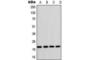 Western blot analysis of CD42c expression in Raji (A), HL60 (B), SP2/0 (C), rat heart (D) whole cell lysates.