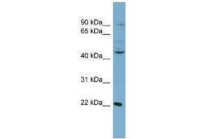 WB Suggested Anti-GOT1 Antibody   Titration: 1 ug/ml   Positive Control: NCI-H226 Whole Cell GOT1 is supported by BioGPS gene expression data to be expressed in NCIH226 (GOT1 antibody  (N-Term))