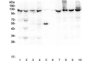 Western blot testing of 1) rat liver, 2) rat lung, 3) mouse liver, 4) mouse lung, 5) rabbit IgG, 6) molecular weight marker, 7) human HepG2, 8) human SMMC-7721, 9) human HeLa and 10) human Jurkat lysate with XPO1 antibody at 0. (XPO1 antibody  (AA 966-1071))