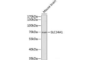 Western blot analysis of extracts of Mouse brain using SLC34A1 Polyclonal Antibody at dilution of 1:1000. (Solute Carrier Family 34 (Type II Sodium/phosphate Contransporter), Member 1 (SLC34A1) antibody)