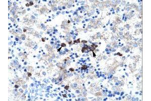 Image no. 1 for anti-Activator of Basal Transcription 1 (Abt1) (AA 174-223) antibody (ABIN202142) (Activator of Basal Transcription 1 antibody  (AA 174-223))