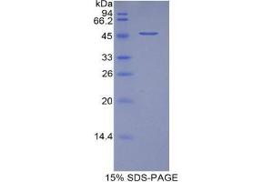 SDS-PAGE analysis of Pig VEGFA Protein.
