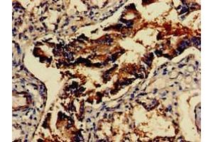 Immunohistochemistry of paraffin-embedded human lung tissue using ABIN7153954 at dilution of 1:100 (GAD65 antibody  (AA 1-82))
