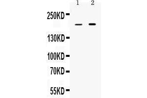 Western blot analysis of Periplakin expression in rat stomach extract ( Lane 1) and HELA whole cell lysates ( Lane 2). (PPL antibody  (C-Term))