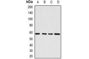 Western blot analysis of SerRS expression in HepG2 (A), Hela (B), mouse kidney (C), rat brain (D) whole cell lysates. (Seryl-tRNA Synthetase (SARS) antibody)