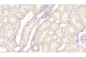 Detection of MAP2K7 in Human Kidney Tissue using Polyclonal Antibody to Mitogen Activated Protein Kinase Kinase 7 (MAP2K7) (MAP2K7 antibody  (AA 113-388))