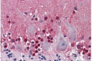 Human Brain, Cerebellum: Formalin-Fixed, Paraffin-Embedded (FFPE) (CBS antibody  (AA 1-101))