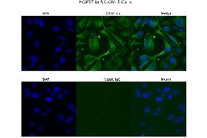 Sample Type : SKOV3  Primary Antibody Dilution: 4 ug/ml  Secondary Antibody : Anti-rabbit Alexa 546  Secondary Antibody Dilution: 2 ug/ml  Gene Name : HOXB7 (HOXB7 antibody  (C-Term))