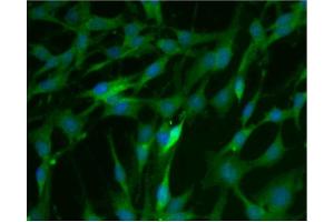 Immunofluorescence (IF) image for anti-Catechol-O-Methyltransferase (COMT) (AA 26-141) antibody (ABIN968704) (COMT antibody  (AA 26-141))