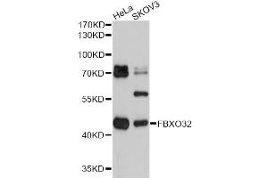 Western blot analysis of extracts of various cell lines, using FBXO32 antibody (ABIN1872667) at 1:2000 dilution.