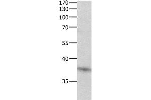 Western Blot analysis of Jurkat cell using DUSP12 Polyclonal Antibody at dilution of 1:500 (DUSP12 antibody)