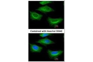 ICC/IF Image Immunofluorescence analysis of paraformaldehyde-fixed HeLa, using beta Tubulin 2, antibody at 1:200 dilution. (TUBB2A antibody)