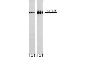 Western blot analysis of NF-kappaB p65 (pS529) in transformed human epithelioid carcinoma. (NFkB antibody  (pSer529))