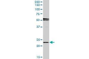 RAB31 MaxPab rabbit polyclonal antibody. (RAB31 antibody  (AA 1-195))