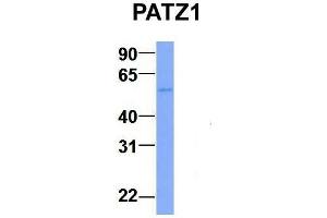 Host:  Rabbit  Target Name:  PATZ1  Sample Type:  Human Adult Placenta  Antibody Dilution:  1. (PATZ1 antibody  (N-Term))