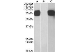 HEK293 lysate (10ug protein in RIPA buffer) overexpressing Human GOLM1 with C-terminal MYC tag probed with ABIN184847 (1ug/ml) in Lane A and probed with anti-MYC Tag (1/1000) in lane C.