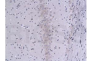 Formalin-fixed and paraffin embedded rat brain labeled with Mouse Anti-Calcineurin A/PP-2B alpha 1 Polyclonal Antibody (ABIN723890), Unconjugated 1:200 followed by conjugation to the secondary antibody and DAB staining (Calcineurin A antibody  (AA 15-80))