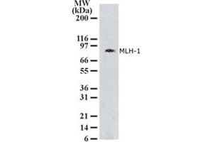 Image no. 1 for anti-MutL Homolog 1 (MLH1) (AA 387-403) antibody (ABIN208109) (MLH1 antibody  (AA 387-403))